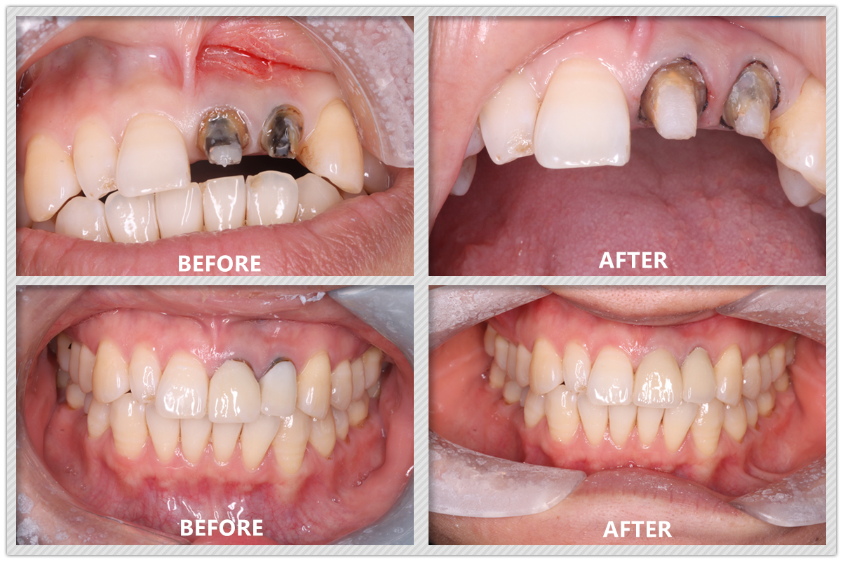 Cosmetic Dentistry